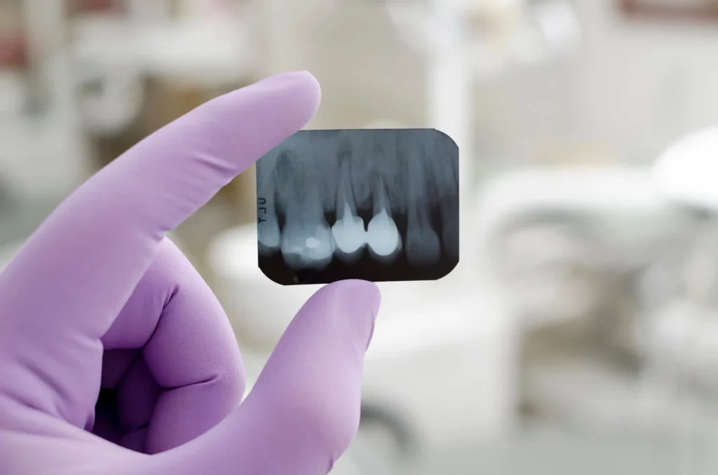 Charlotte Preventative Dentist