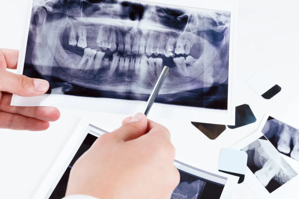 Dentist addressing issues for a full mouth reconstruction charlotte nc