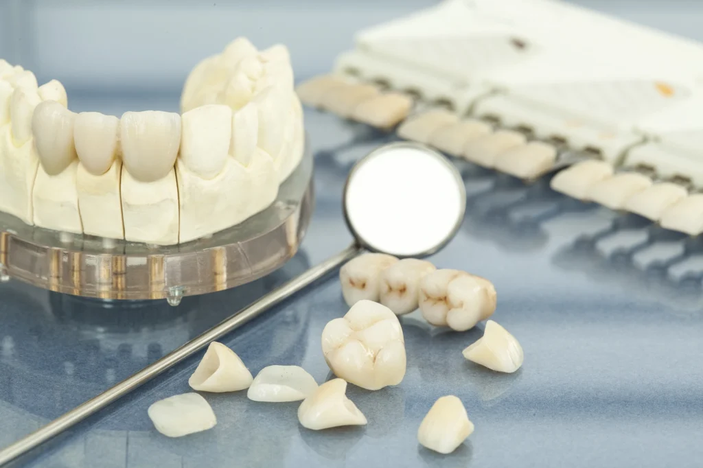 header shot of porcelain veneers charlotte​