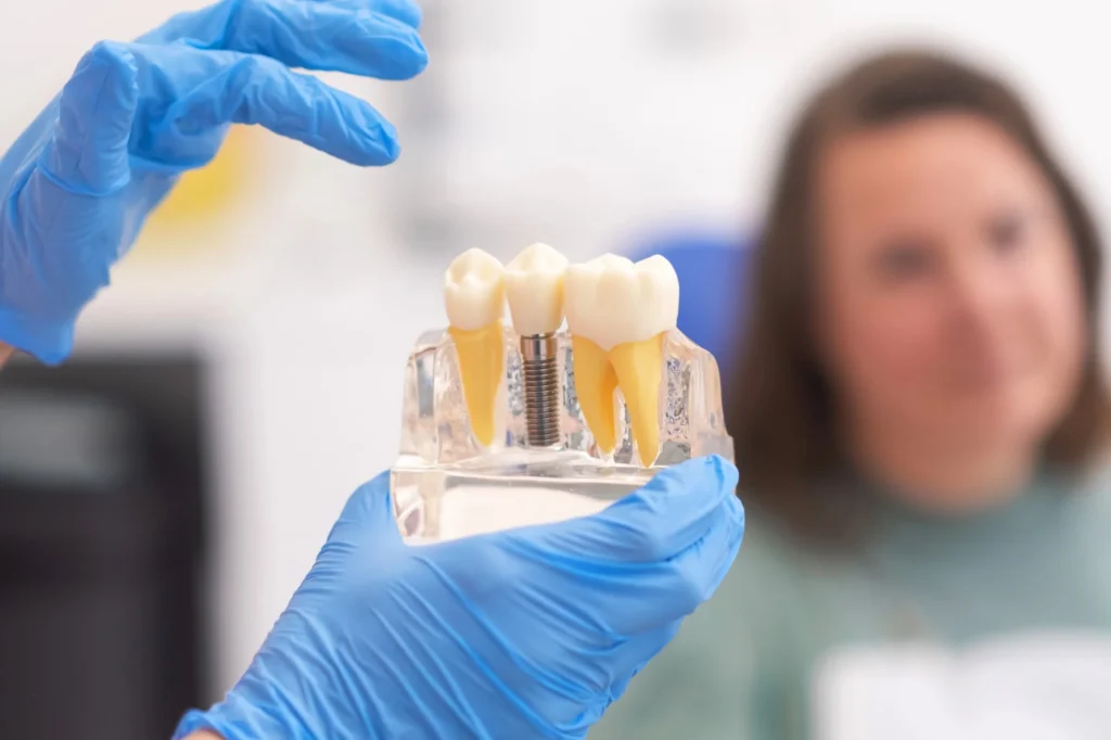 dental implants charlotte implant model consultation