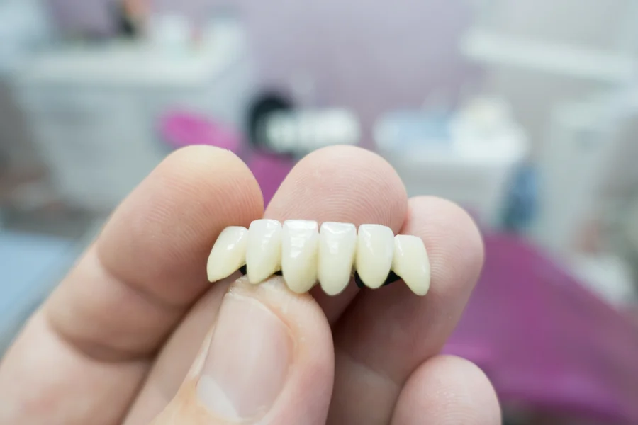 dental crowns charlotte closeup of dental bridge crown in hand