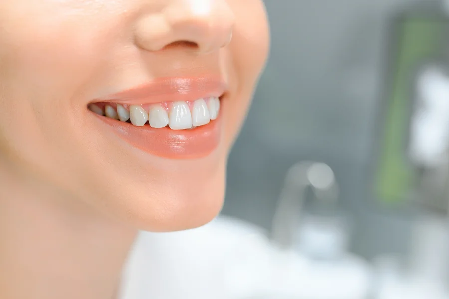 teeth whitening charlotte close up of bright white smile