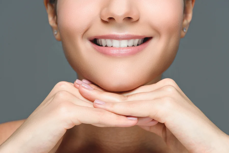teeth whitening charlotte smile with white teeth and hands under chin